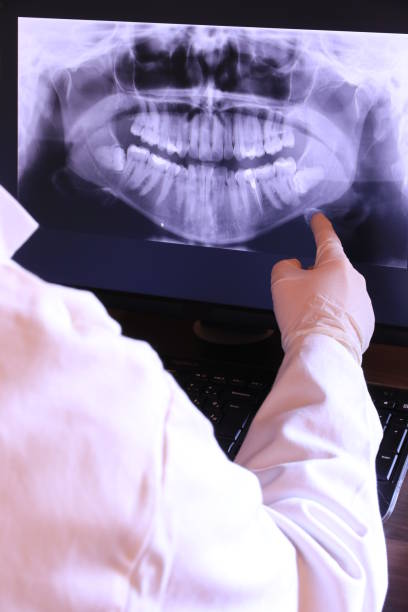 Best Emergency Treatment for Oral Infections in Williamsport, IN